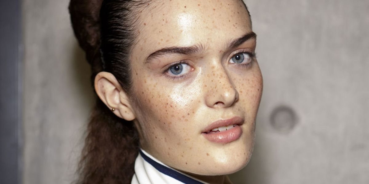 Taches de rousseur : l'anti-âge inattendu