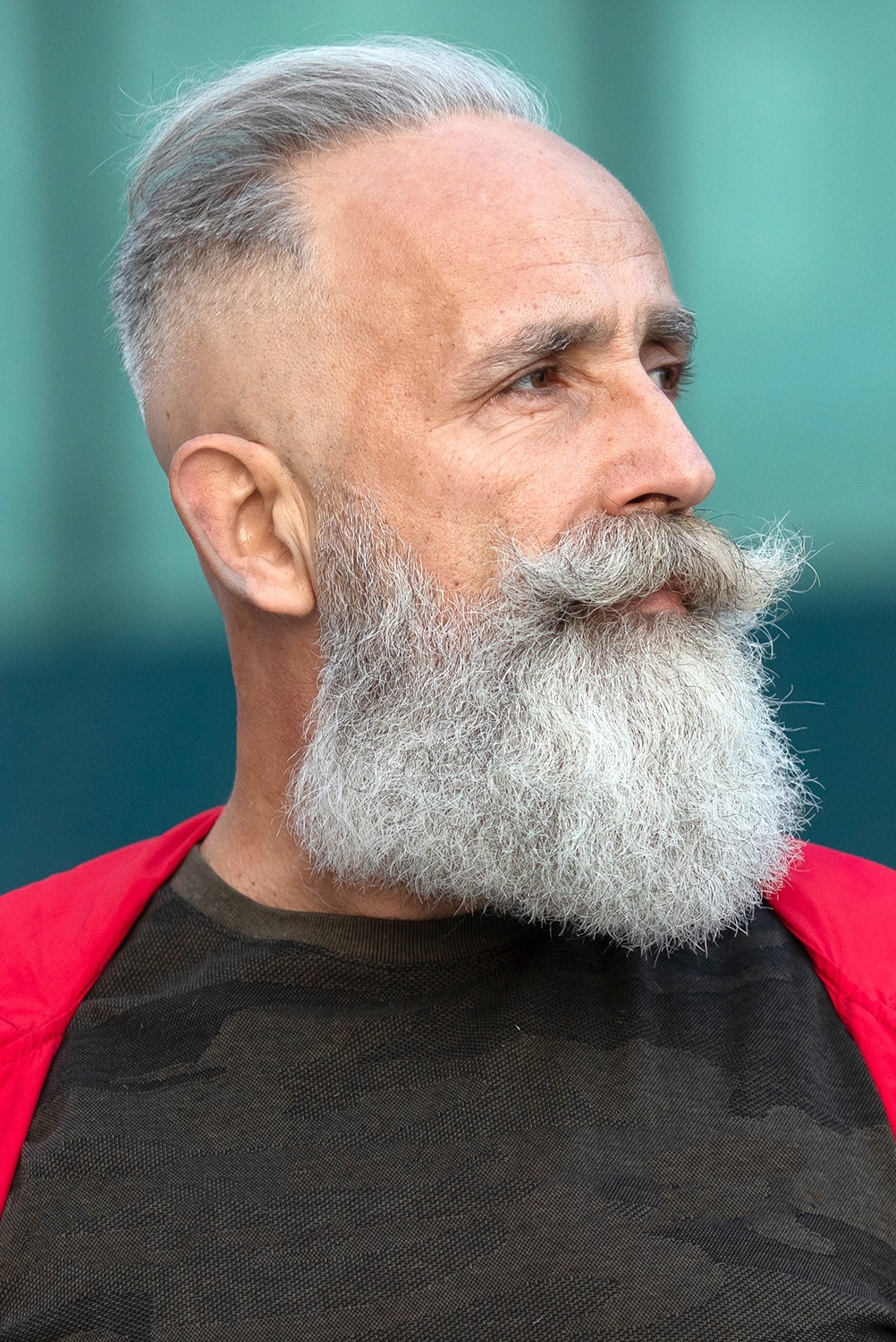 Décoloration de la peau coupée avec barbe depuis plus de 50 ans