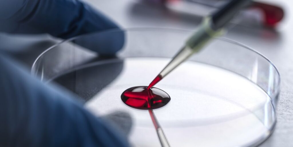 Ce petit test sanguin pourrait révolutionner le diagnostic de la ...