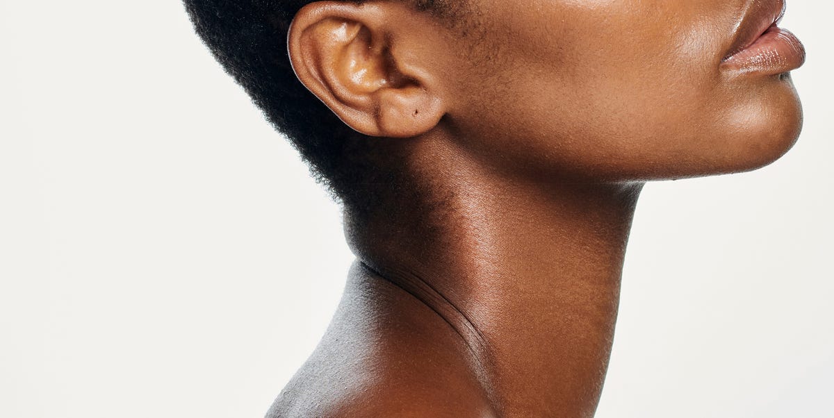 Comment resserrer et raffermir un cou vieillissant - sans chirurgie